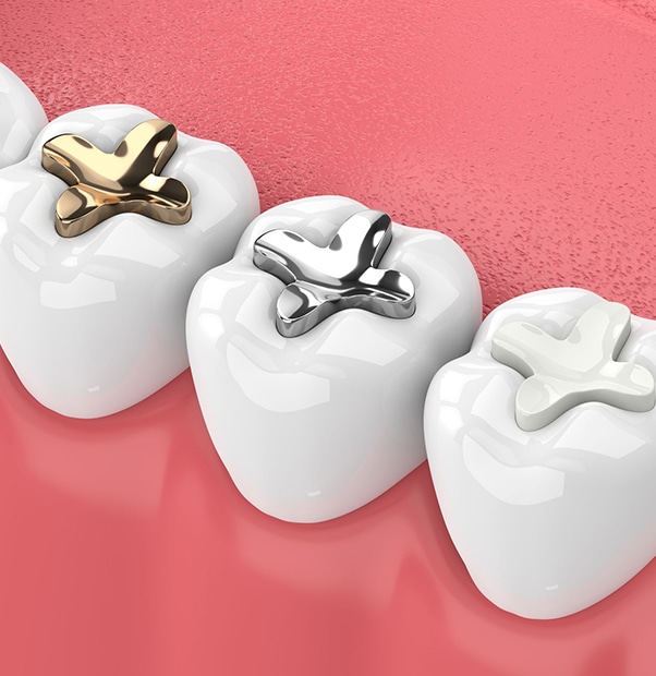 Three dental crowns showing progression from gold to silver to white on pink background.