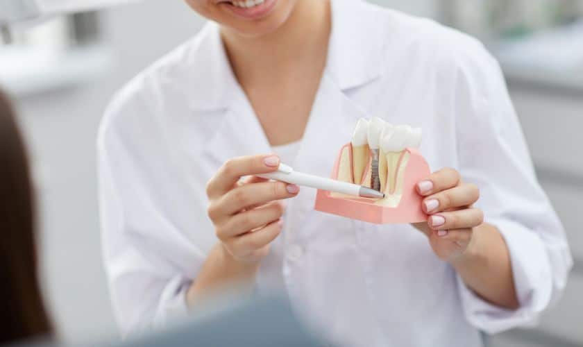 Dental Implant in Santa Fe